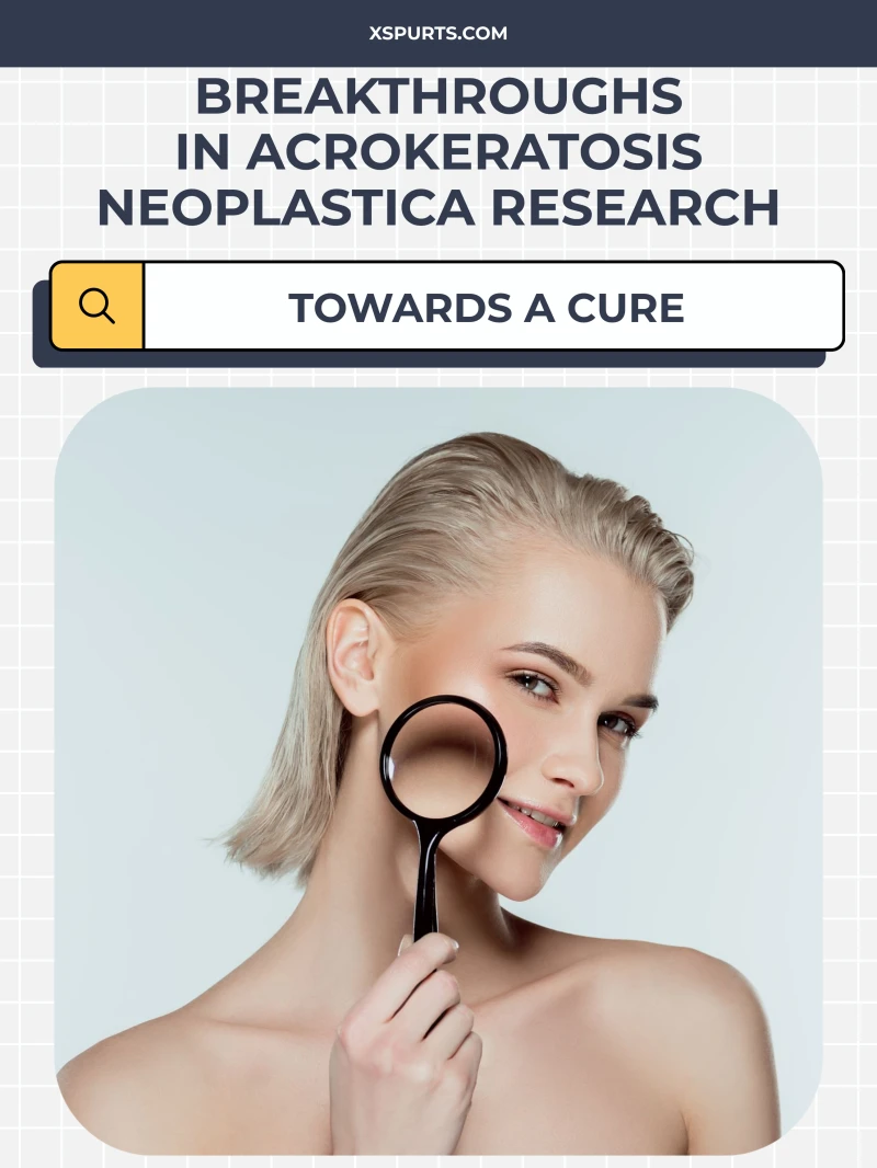 Portada: Breakthroughs in Acrokeratosis Neoplastica Research