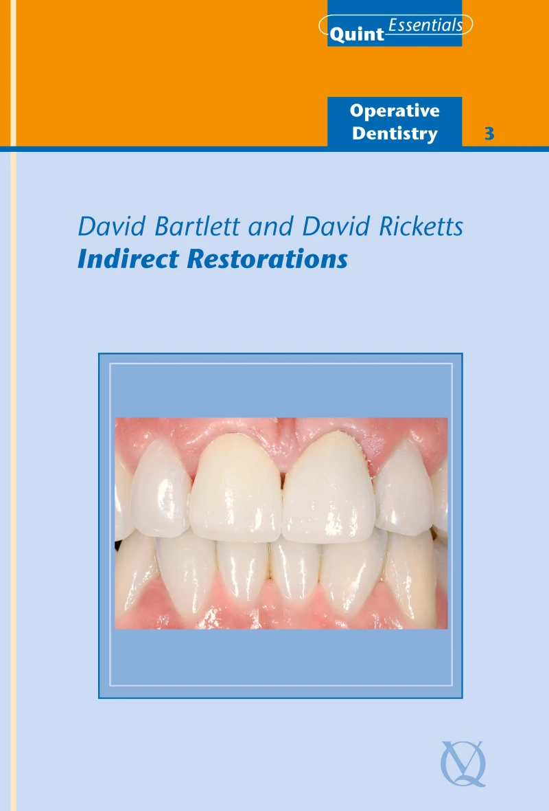 Portada: Indirect Restorations