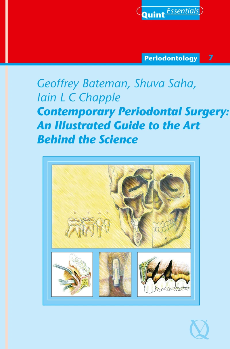 Portada: Contemporary Periodontal Surgery