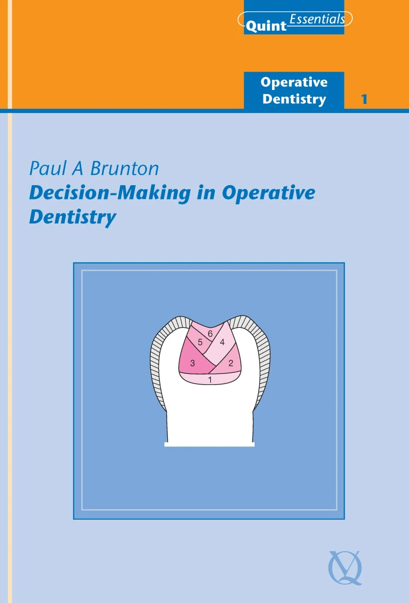 Portada: Decision-Making in Operative Dentistry