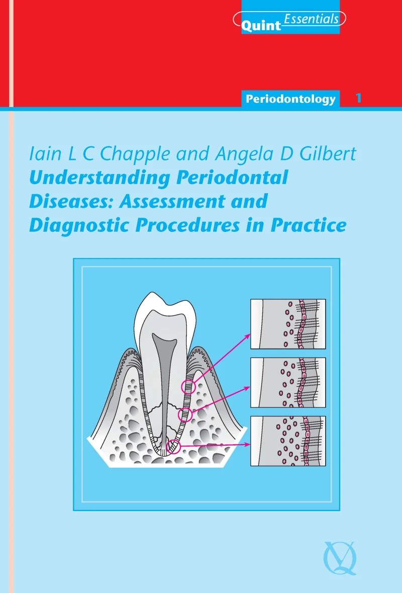 Portada: Understanding Periodontal Diseases: Assessment and Diagnostic Procedures in Practice