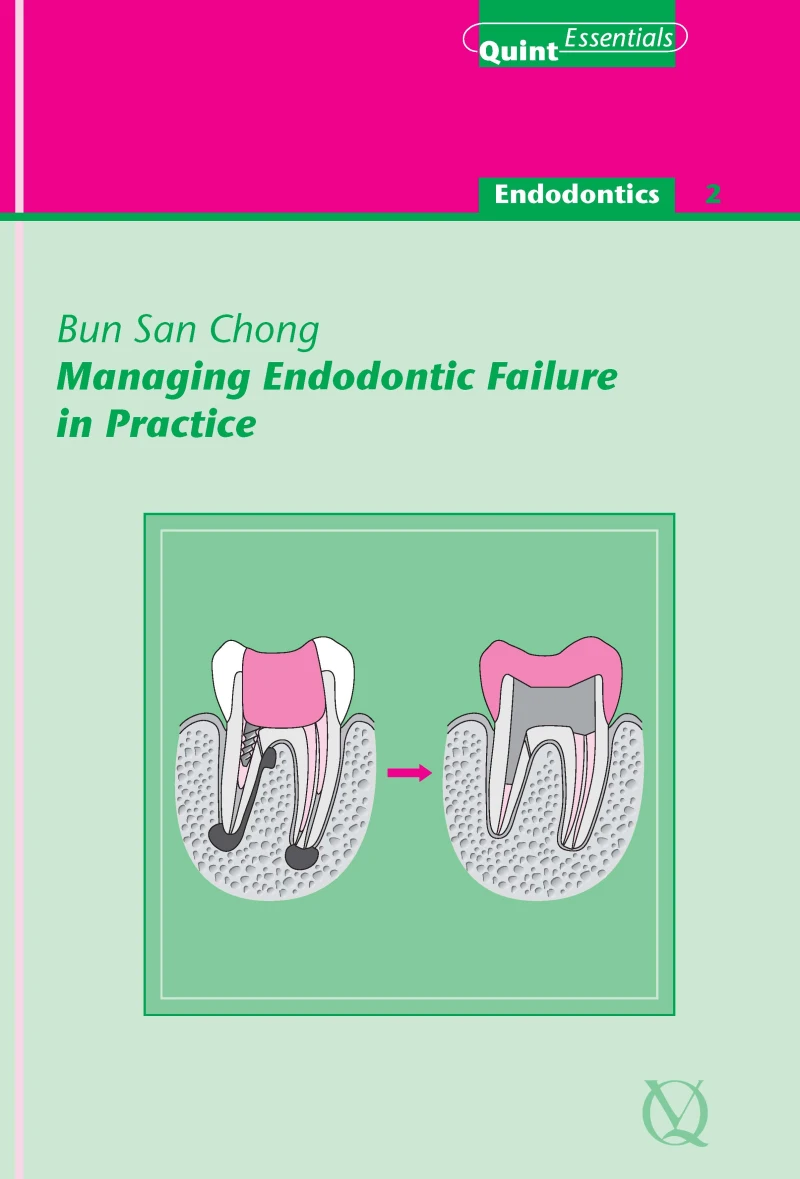 Portada: Managing Endodontic Failure in Practice