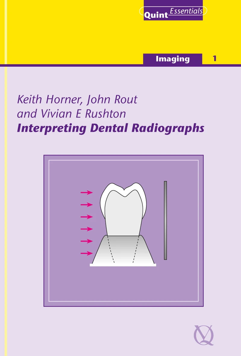 Portada: Interpreting Dental Radiographs
