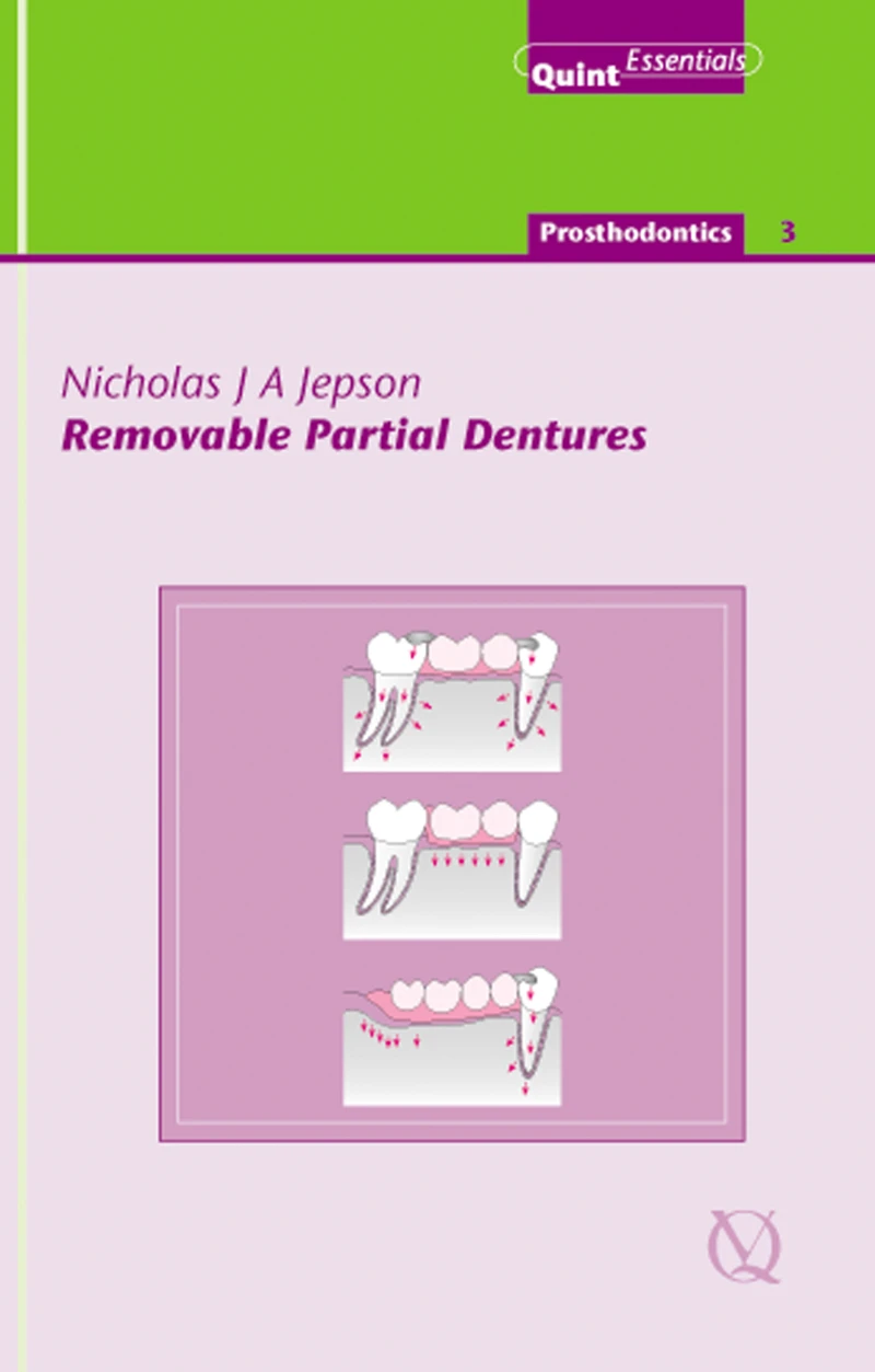 Portada: Removable Partial Dentures