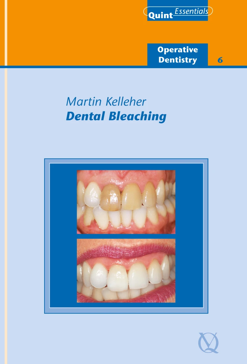 Portada: Dental Bleaching