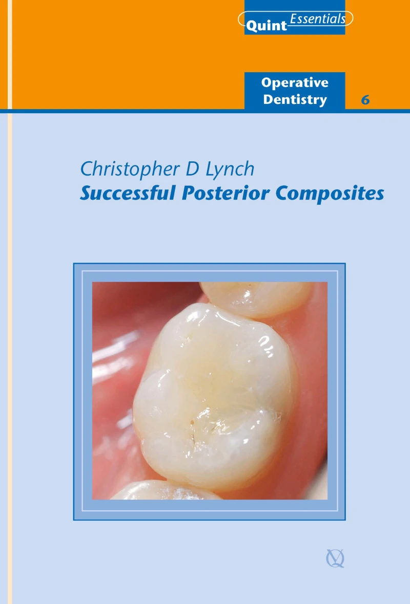 Portada: Successful Posterior Composites