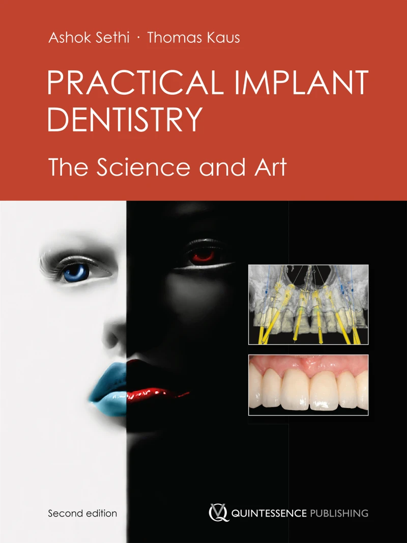 Portada: Practical Implant Dentistry
