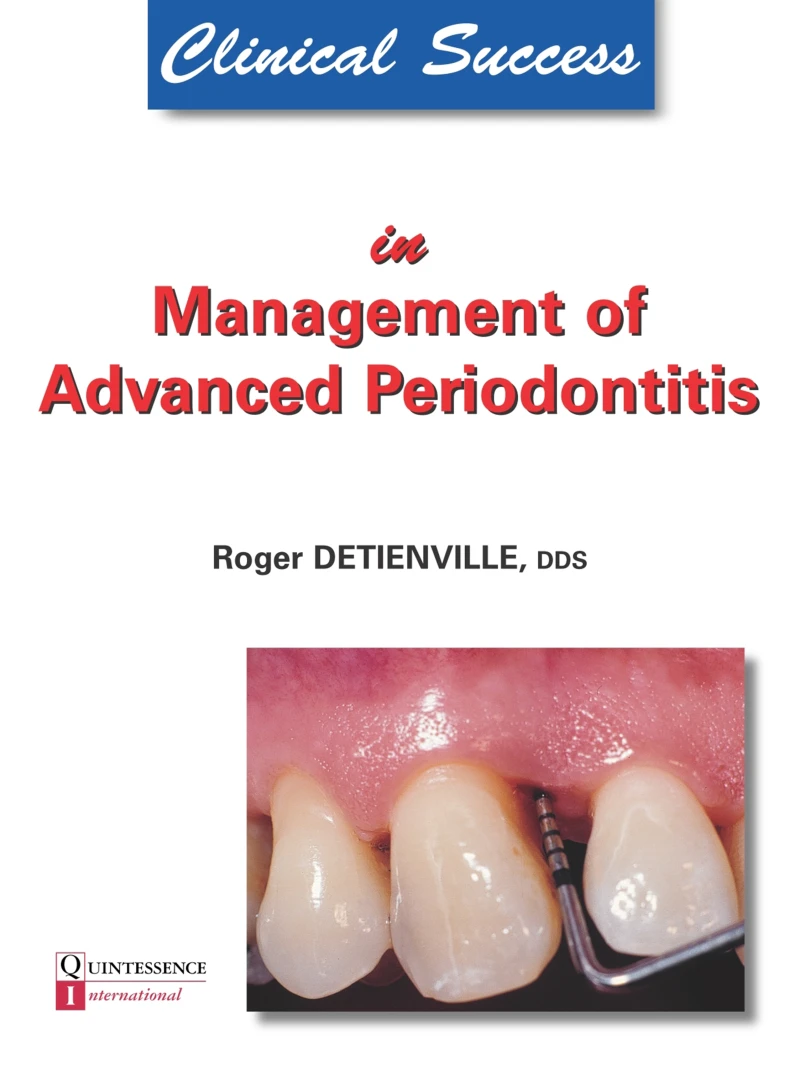Portada: Clinical Success in Management of Advanced Periodontitis