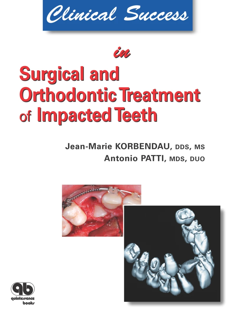 Portada: Clinical Success in Surgical and Orthodontic Treatment of Impacted Teeth