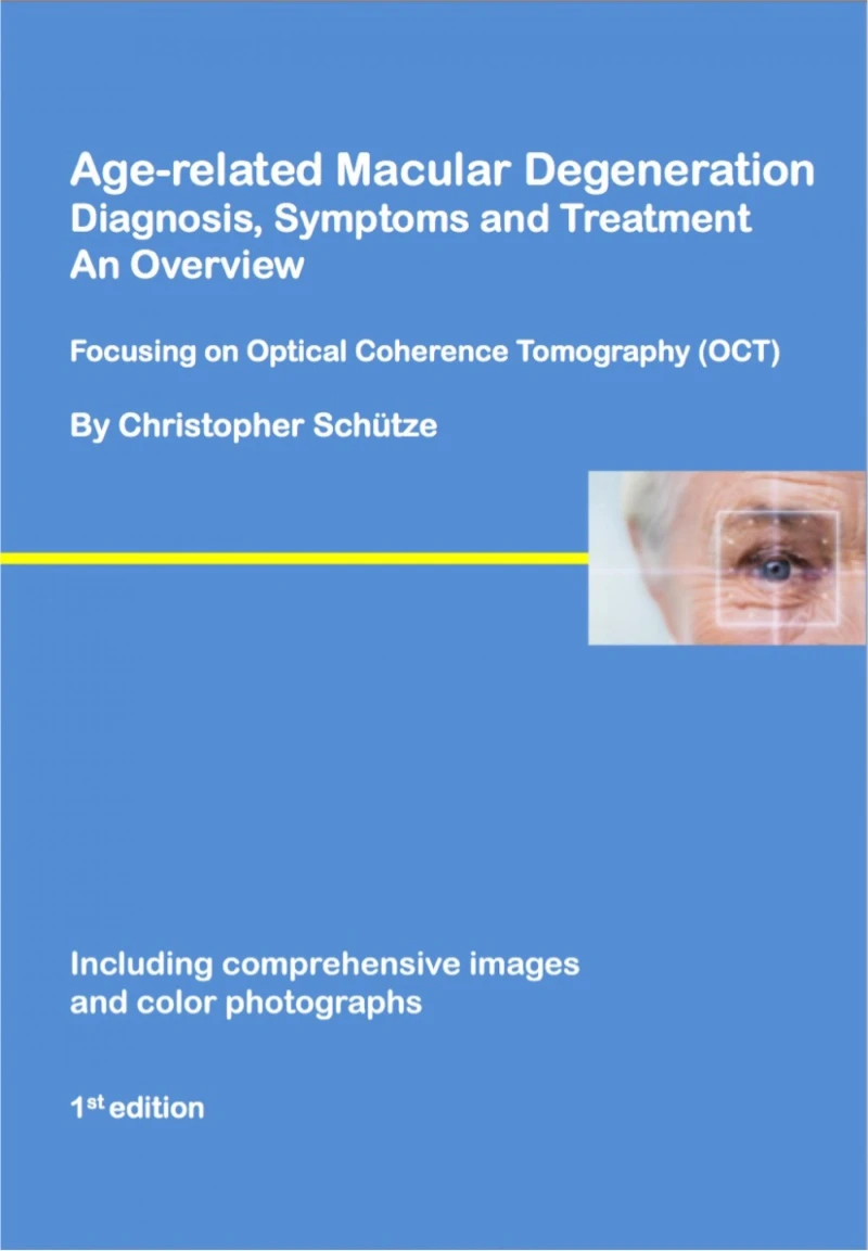 Portada: Age-related macular degeneration