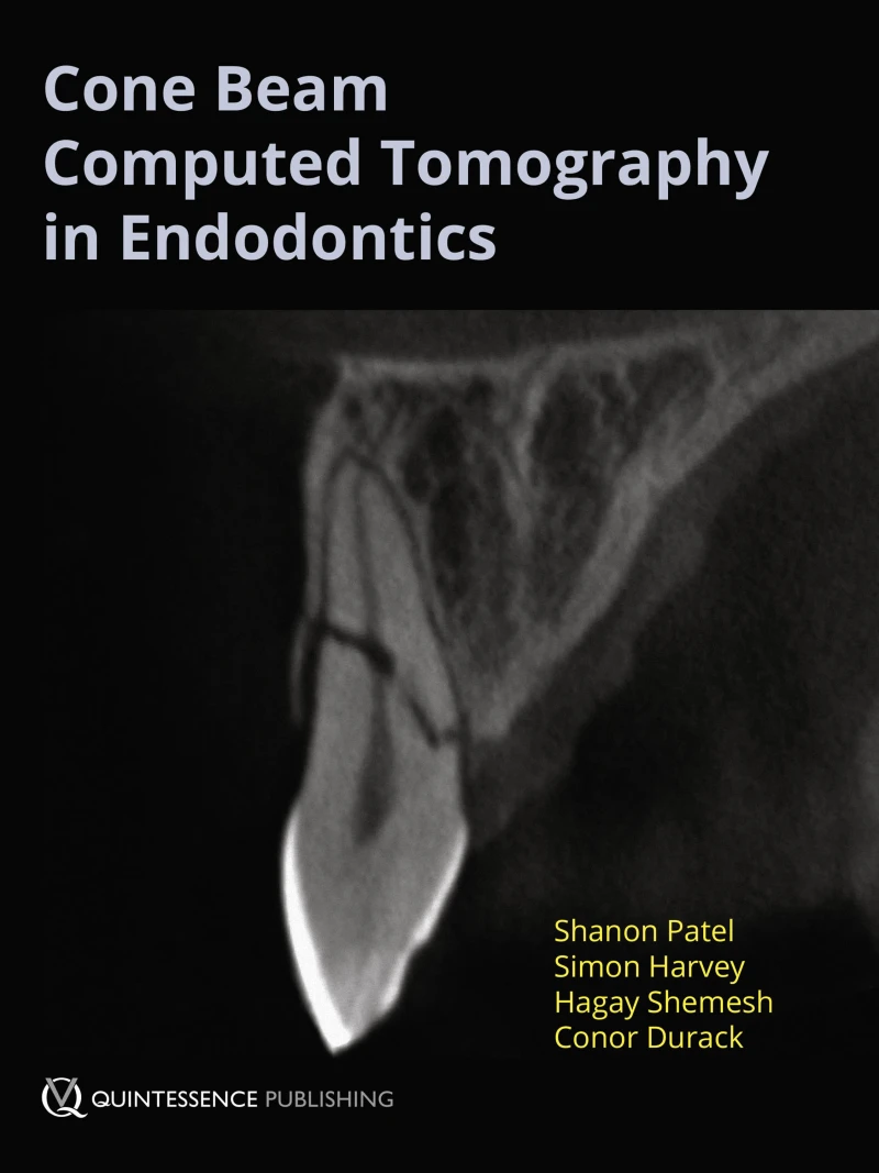 Portada: Cone Beam Computed Tomography in Endodontics