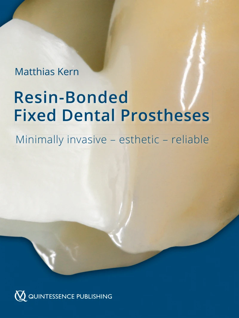 Portada: Resin-Bonded Fixed Dental Prostheses