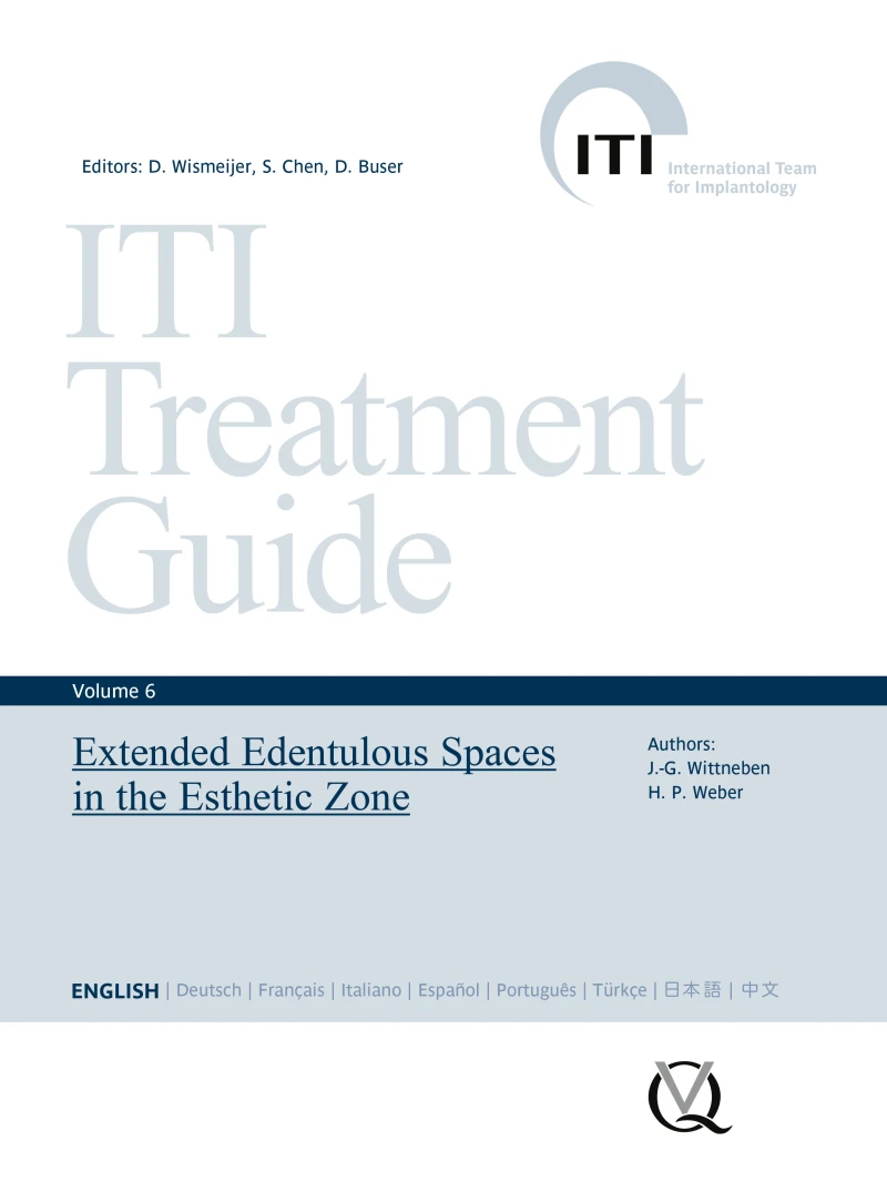 Portada: Extended Edentulous Spaces in the Esthetic Zone