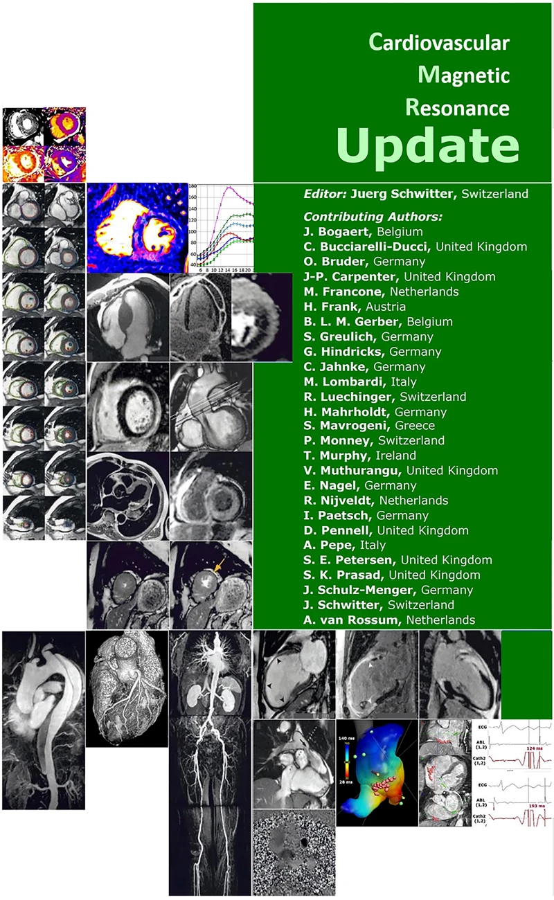 Portada: Cardiovascular Magnetic Resonance Update