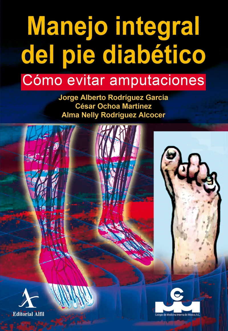 Portada: Manejo integral del pie diabético. Cómo evitar amputaciones