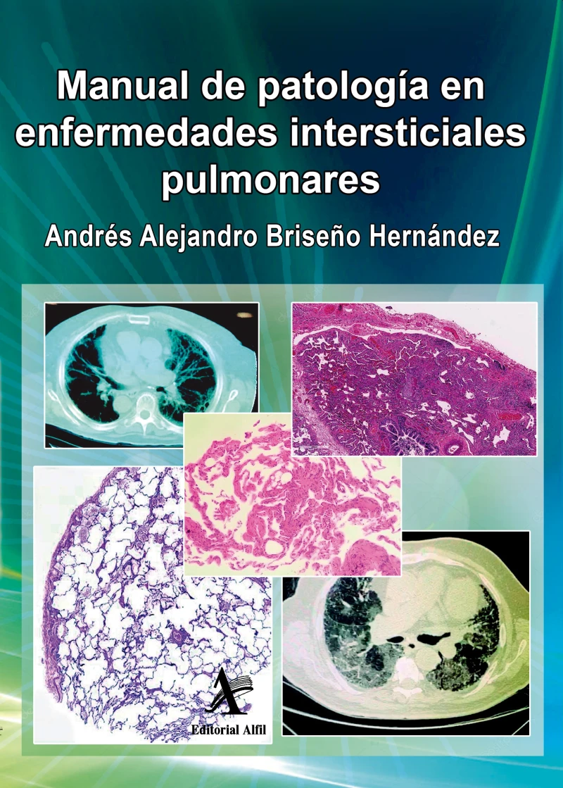 Portada: Manual de patología en enfermedades intersticiales pulmonares