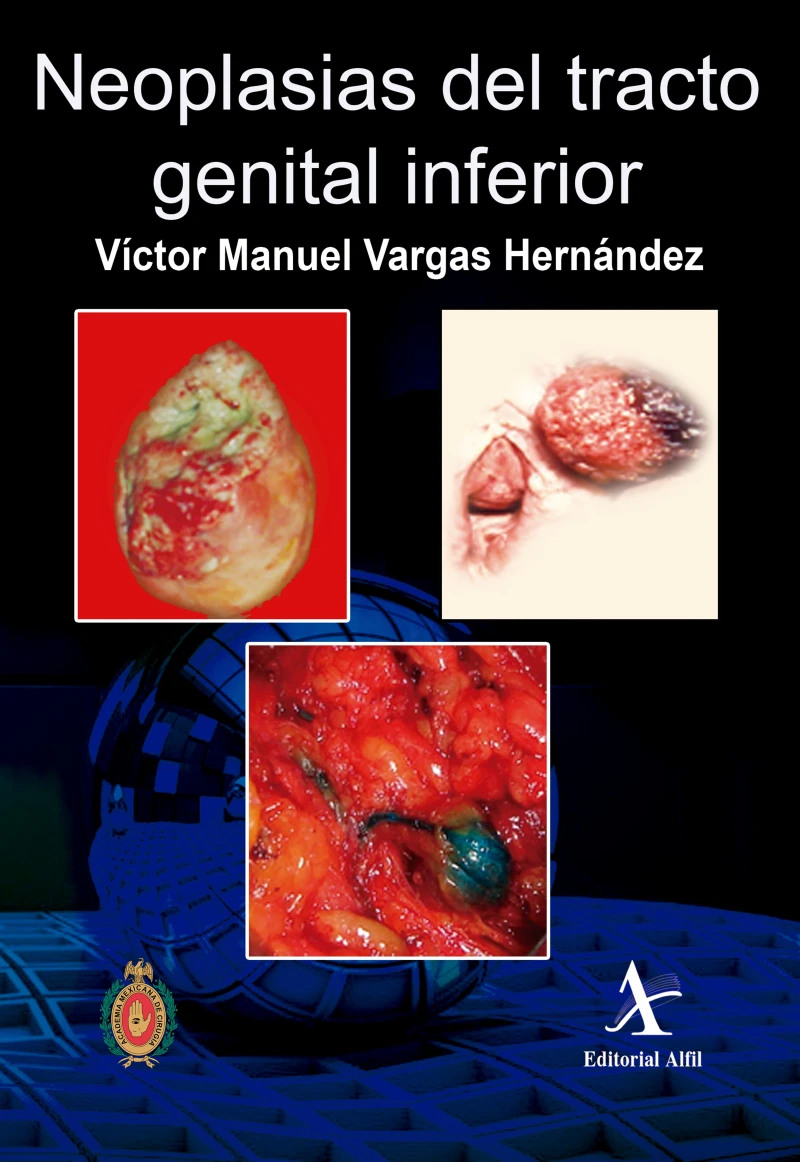 Portada: Neoplasias del tracto genital inferior