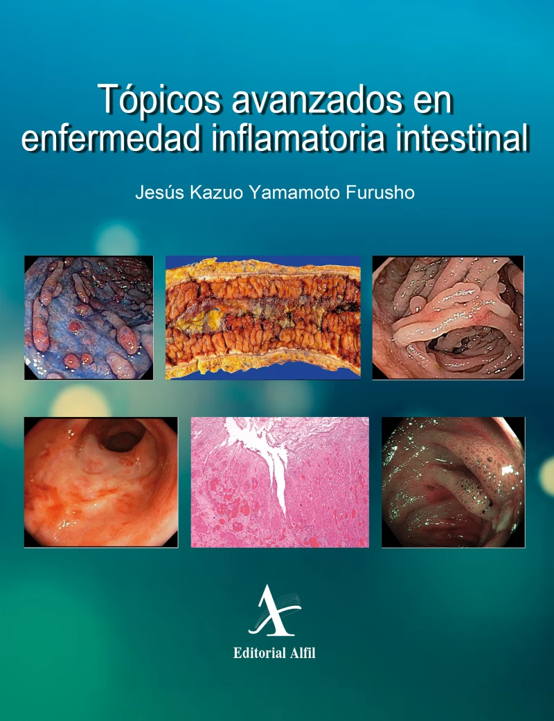 Portada: Tópicos avanzados en enfermedad inflamatoria intestinal