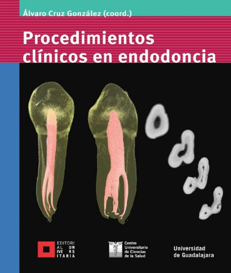 Portada: Procedimientos clínicos en endodoncia