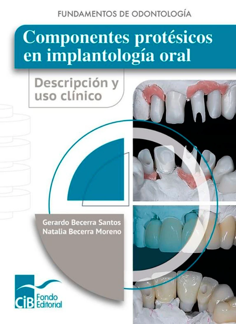 Portada: Componentes protésicos en implantología oral
