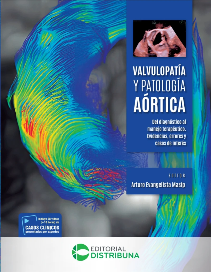 Portada: Valvulopatía y patología aórtica