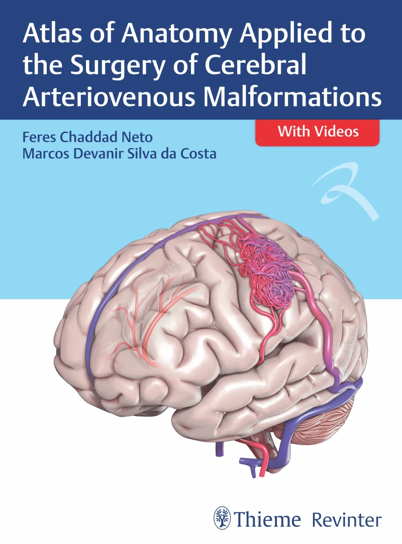 Portada: Atlas Of Anatomy Applied To The Surgery Of Cerebral Arteriovenous Malformations