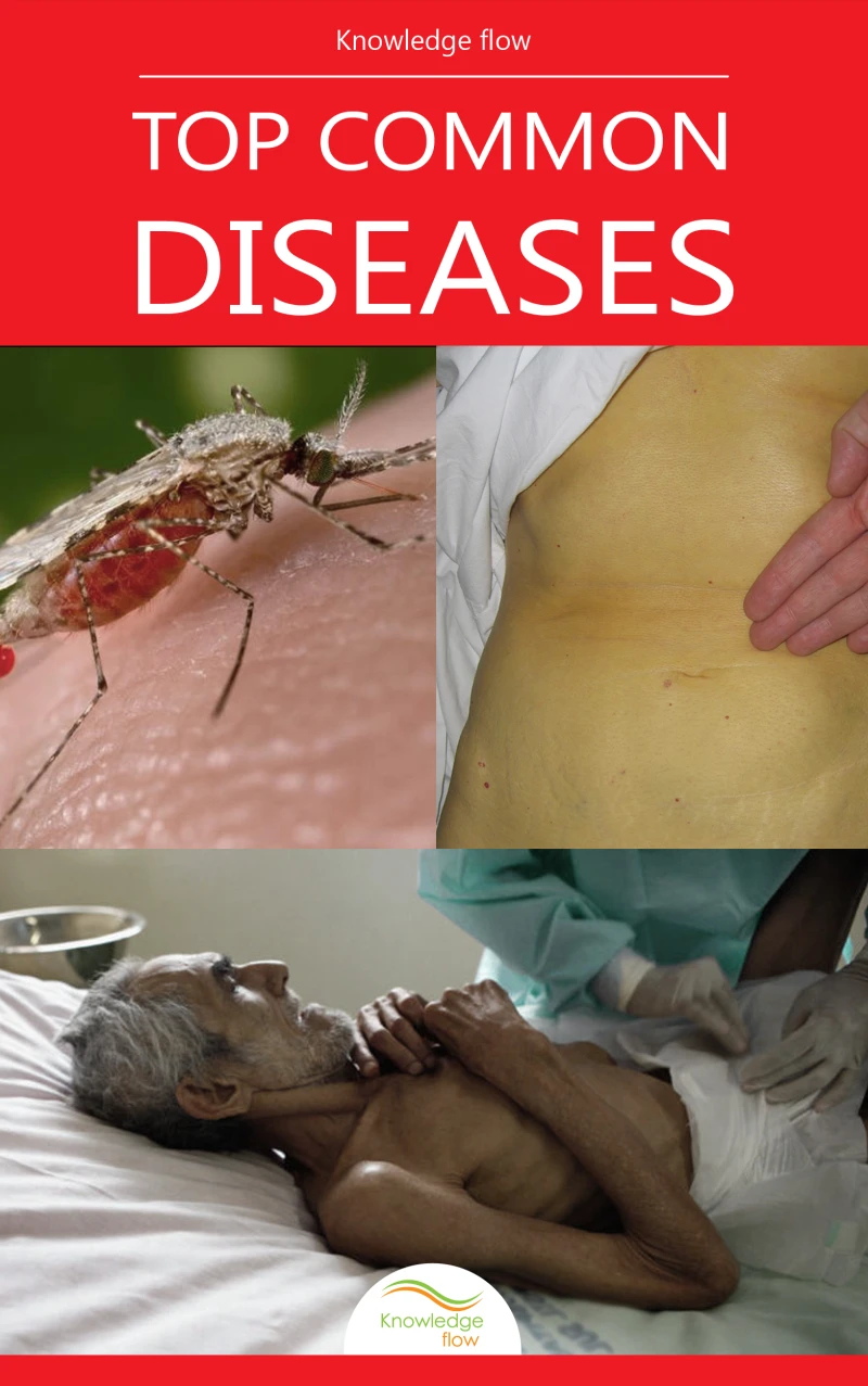 Portada: Top Common Diseases