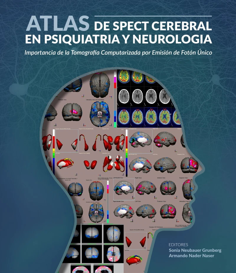Portada: Atlas de spect cerebral en psiquiatria y neurología
