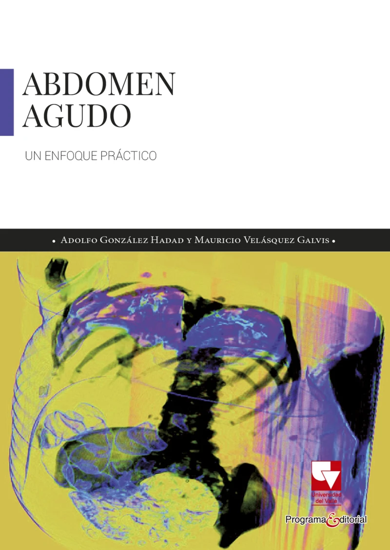 Portada: Abdomen agudo