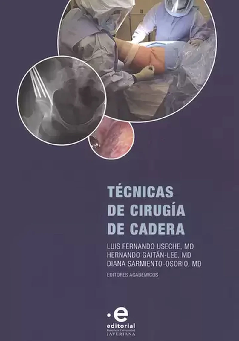Portada: Técnicas de cirugía de cadera