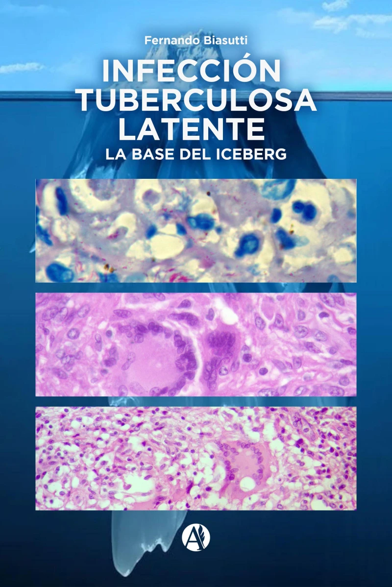 Portada: Infección Tuberculosa Latente, la base del iceberg