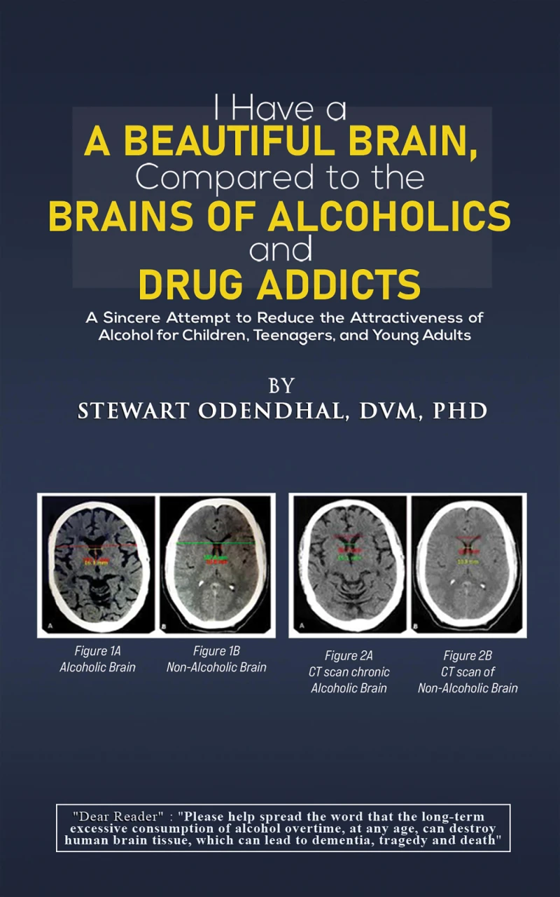 Portada: I Have a Beautiful Brain, Compared to the Brains of Alcoholics and Drug Addicts