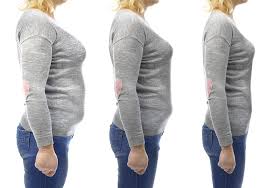 Coolsculpting By Sculptology
