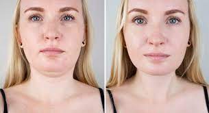 Sculptology Body Sculpting