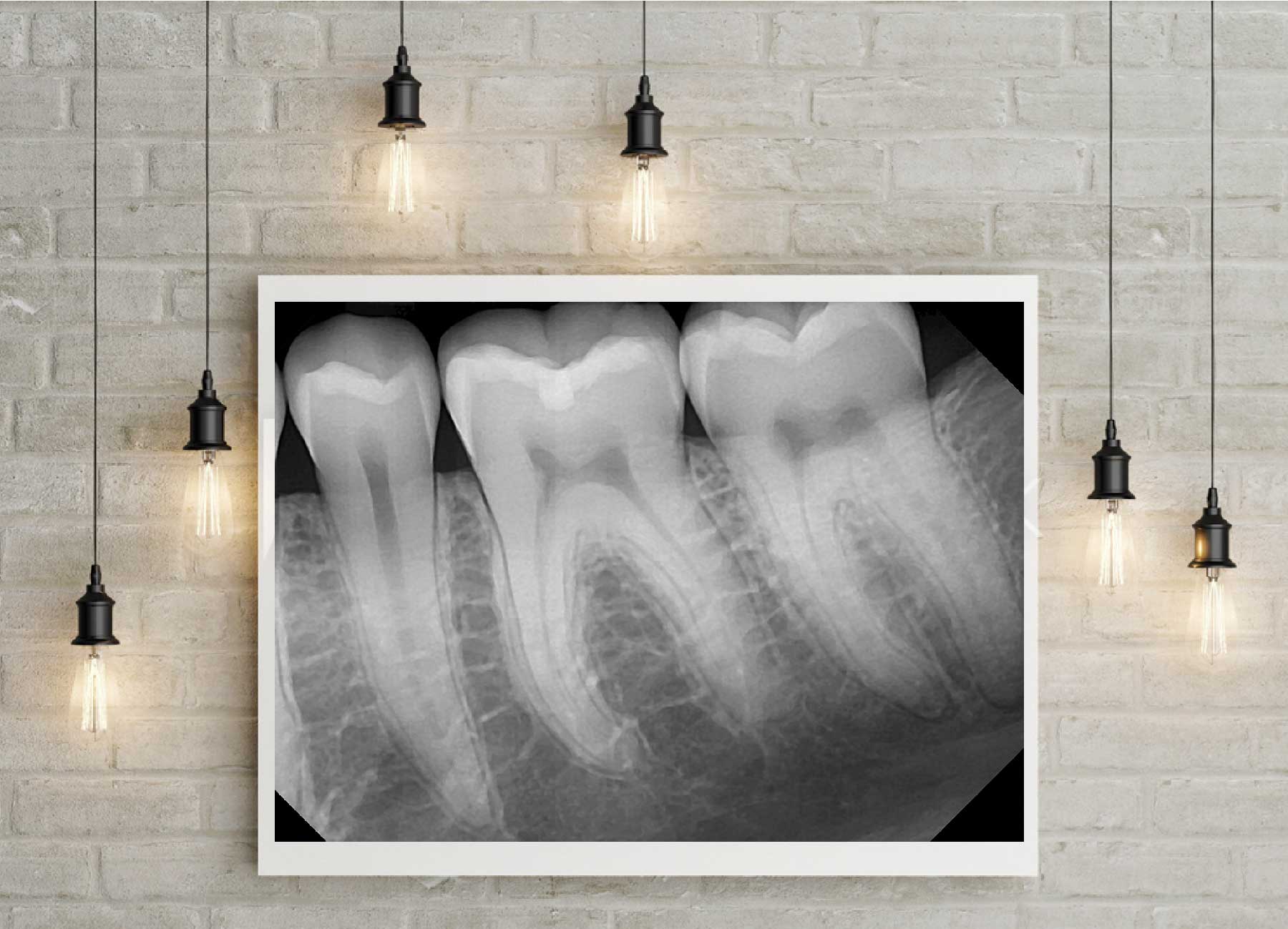 Image about digital dental x-rays