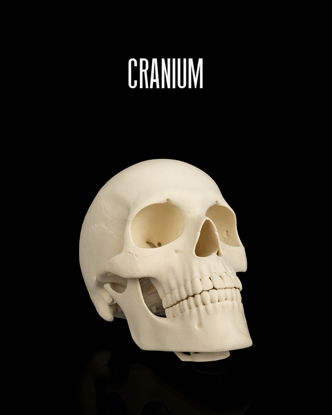 Cranium