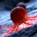 Cientistas destroem 99% das células cancerígenas em laboratório usando moléculas vibratórias
