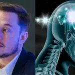 Exclusivo: Elon Musk quebra o silêncio sobre o implate de chip cerebral da Neuralink 1