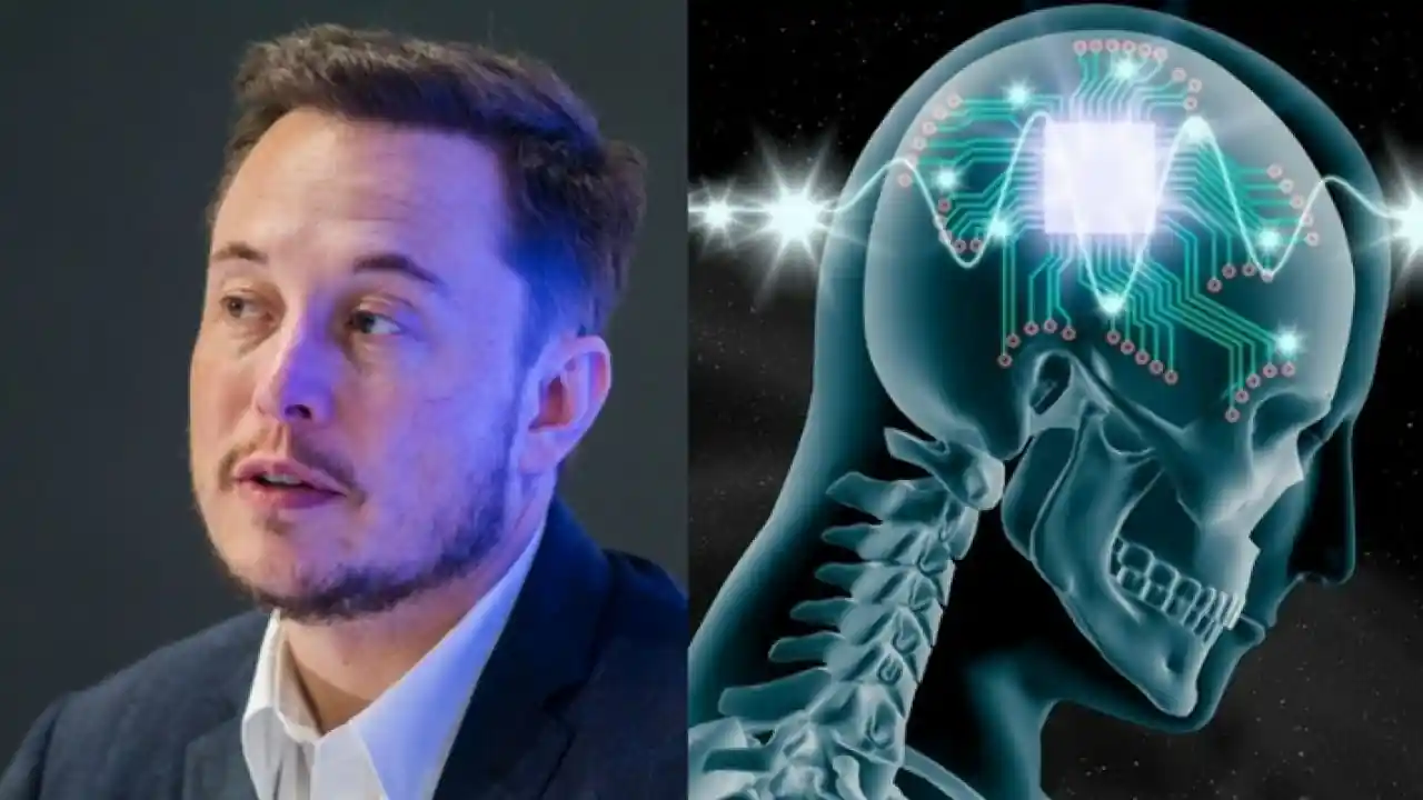 Exclusivo: Elon Musk quebra o silêncio sobre o implate de chip cerebral da Neuralink 2