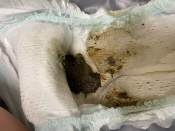 Consumer Review - Food Safety Costco Wholesale, Lomita Boulevard, Torrance, CA, EUA My family and I eat roast chicken on Tuesday.... photo #2