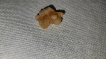 Consumer Food Safety Report Wegmans, Latta Road, Rochester, NY, USA I recently purchased a bag of Black Forest Organic Gummy Bea... photo #2