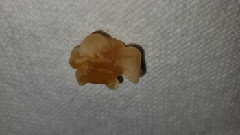 Consumer Food Safety Report Wegmans, Latta Road, Rochester, NY, USA I recently purchased a bag of Black Forest Organic Gummy Bea... photo #7