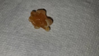 Consumer Food Safety Report Wegmans, Latta Road, Rochester, NY, USA I recently purchased a bag of Black Forest Organic Gummy Bea... photo #8