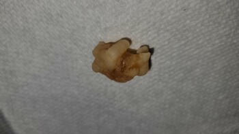 Consumer Food Safety Report Wegmans, Latta Road, Rochester, NY, USA I recently purchased a bag of Black Forest Organic Gummy Bea... photo #11