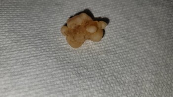 Consumer Food Safety Report Wegmans, Latta Road, Rochester, NY, USA I recently purchased a bag of Black Forest Organic Gummy Bea... photo #12