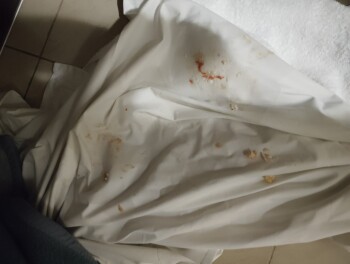 Consumer Review - Food Safety Eurohotel Katrin hotel & bungalows, Ειρήνης, Stalis, Greece Bonsoir,  Ma fille de 5 ans vomi depuis... photo #7