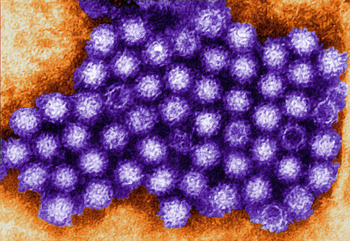 Outbreak Norovirus Outbreak in Royal Preston Hospital A norovirus outbreak has led to the closure of a ward a... photo #1