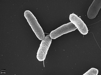 Irruption Salmonella Outbreak Investigation Linked to Backyard Poultry Public health officials are investigati... photo #2