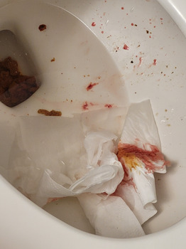 消费者评论 - 食品安全 Domino's Pizza, Trunk Road, Sault Ste. Marie, ON, Canada I was poisoned by Dominio's pizza im in my... 照片 #3