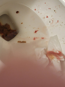 مراجعة المستهلك - سلامة الغذاء Domino's Pizza, Trunk Road, Sault Ste. Marie, ON, Canada I was poisoned by Dominio's pizza im in my... صورة فوتوغرافية #4